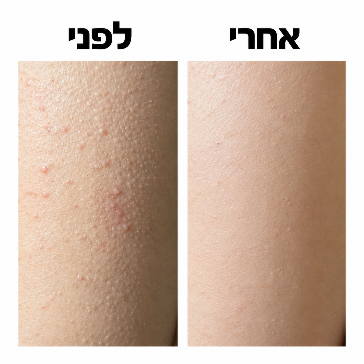 LIORA סטיק חומצה גליקולית לגוף