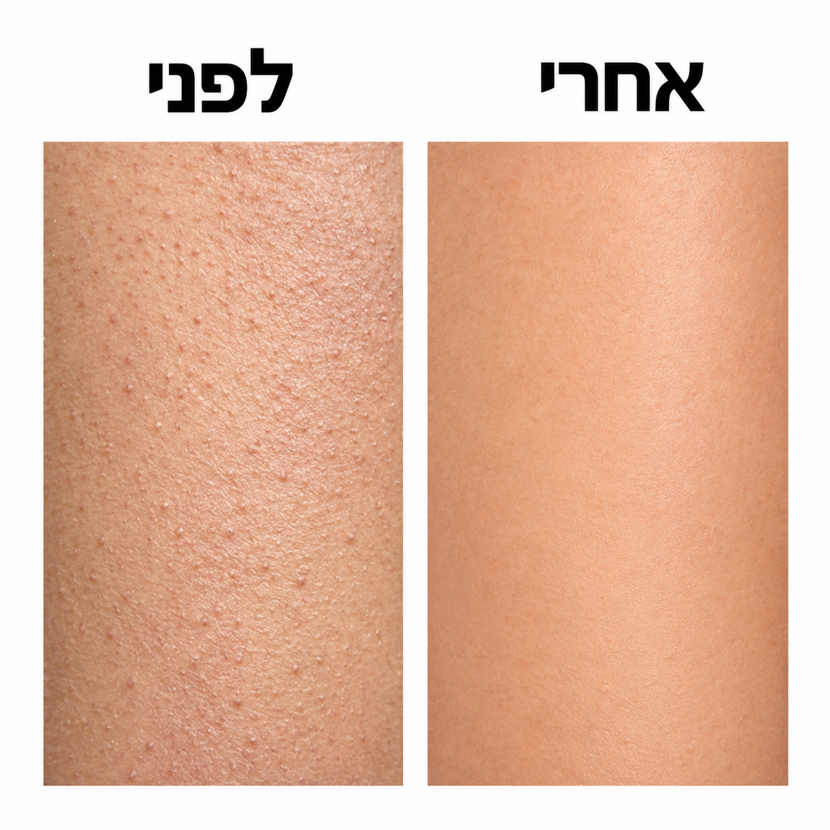 LIORA סטיק חומצה גליקולית לגוף