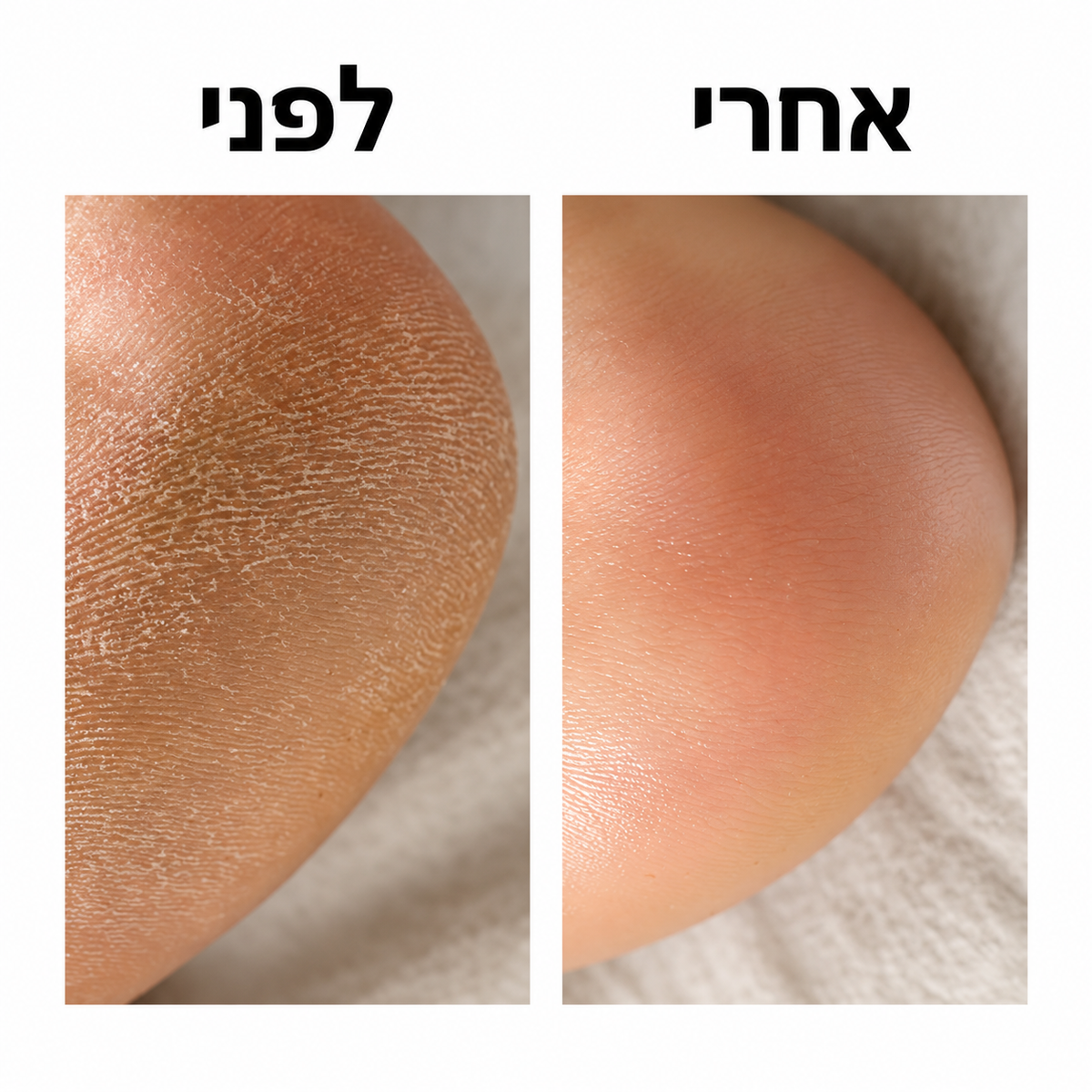 LIORA סטיק חומצה גליקולית לגוף